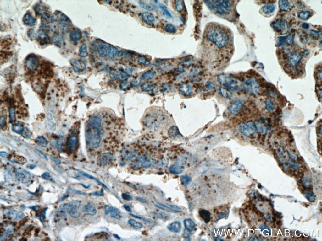 Inhibin Beta A Polyclonal antibody