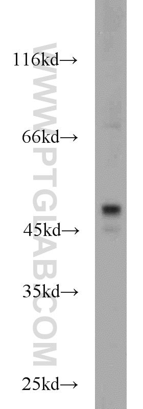 Western Blot (WB) analysis of HeLa cells using Inhibin Beta A Polyclonal antibody (10651-1-AP)