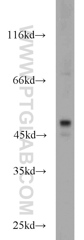 WB analysis of HeLa using 10651-1-AP