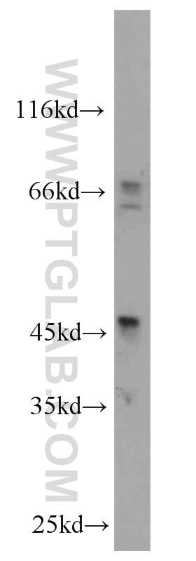 Western Blot (WB) analysis of SGC-7901 cells using Inhibin Beta A Polyclonal antibody (10651-1-AP)