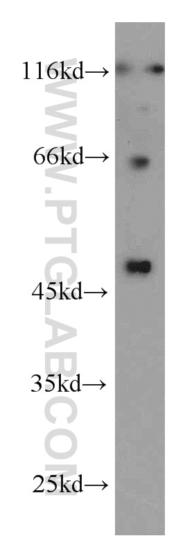 Western Blot (WB) analysis of MCF-7 cells using Inhibin Beta A Polyclonal antibody (10651-1-AP)