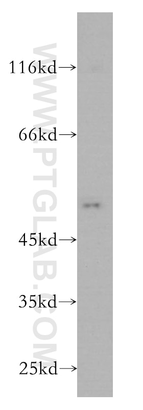 Western Blot (WB) analysis of human brain tissue using Inhibin Beta A Monoclonal antibody (60015-1-Ig)