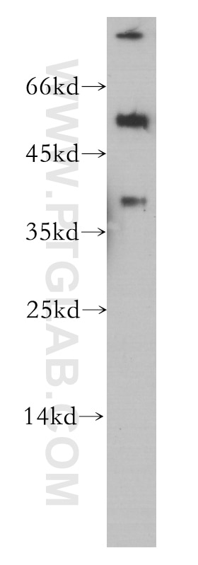 Western Blot (WB) analysis of human brain tissue using Inhibin Beta A Monoclonal antibody (60015-1-Ig)