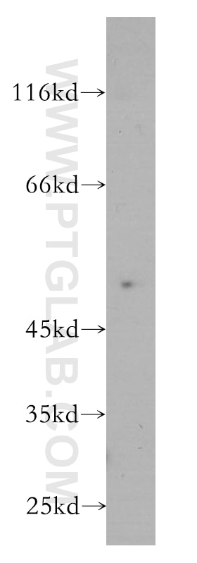 Western Blot (WB) analysis of human brain tissue using Inhibin Beta A Monoclonal antibody (60015-2-Ig)
