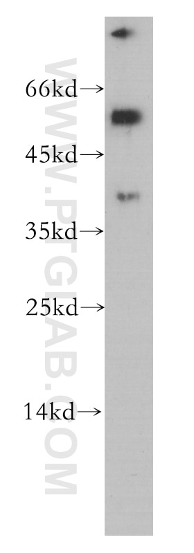 Western Blot (WB) analysis of human brain tissue using Inhibin Beta A Monoclonal antibody (60015-2-Ig)