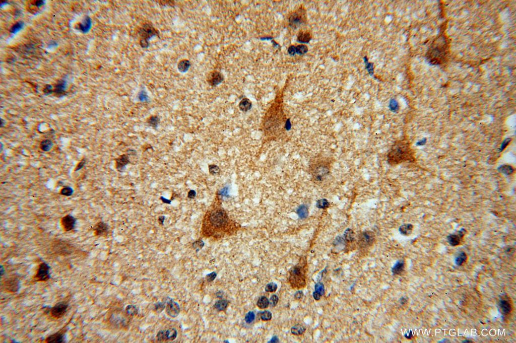 Inhibin beta A-Specific