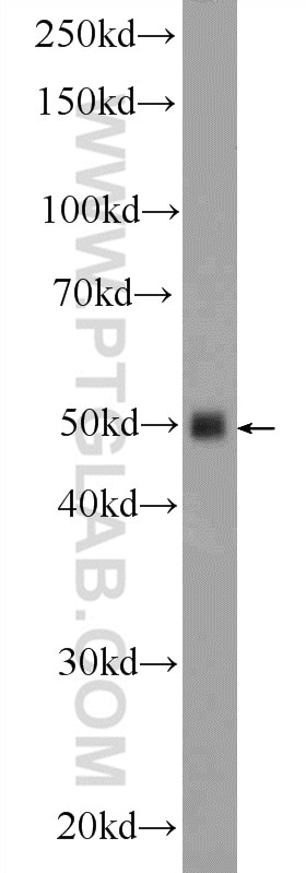 Western Blot (WB) analysis of mouse brain tissue using Inhibin beta A-Specific Polyclonal antibody (17524-1-AP)