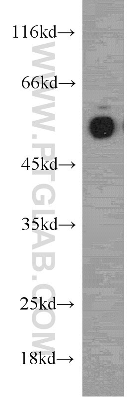 Western Blot (WB) analysis of rat brain tissue using Inhibin beta A-Specific Polyclonal antibody (17524-1-AP)