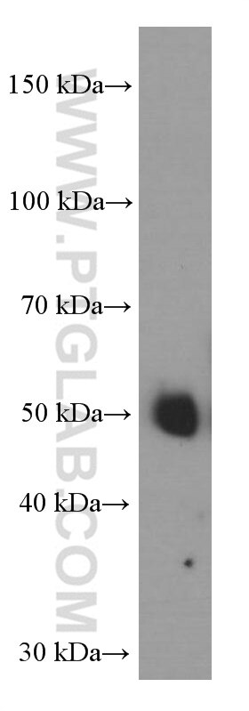 Western Blot (WB) analysis of human testis tissue using Inhibin beta A-Specific Monoclonal antibody (60352-1-Ig)
