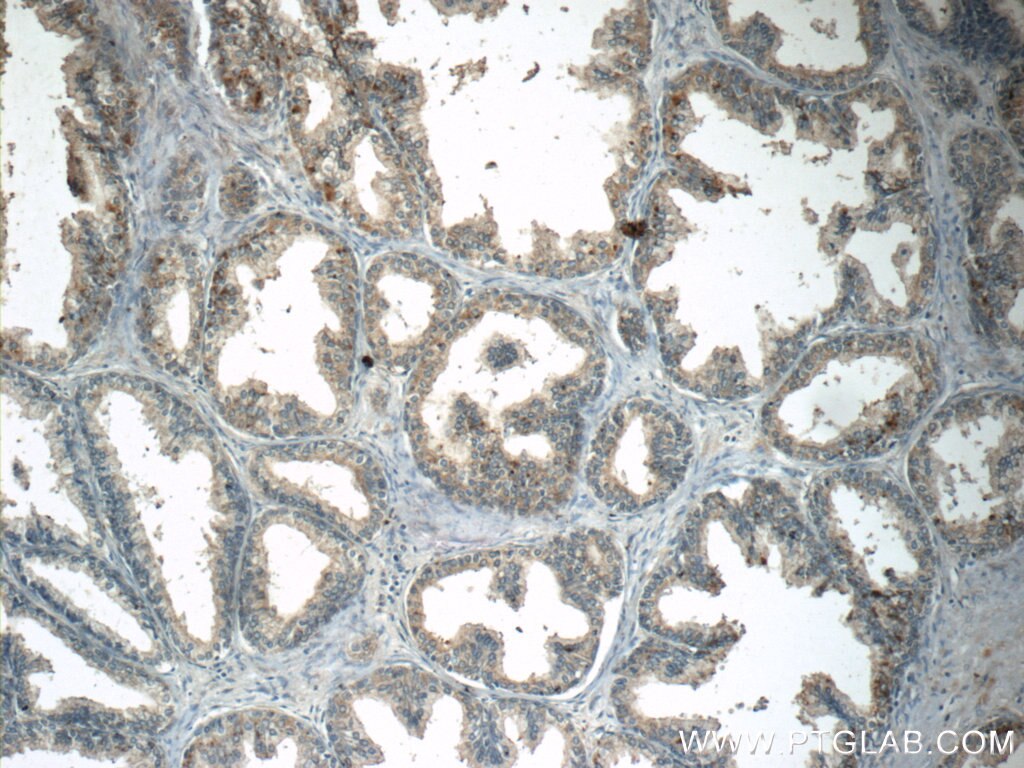 Immunohistochemistry (IHC) staining of human prostate hyperplasia tissue using INHBC Polyclonal antibody (24196-1-AP)