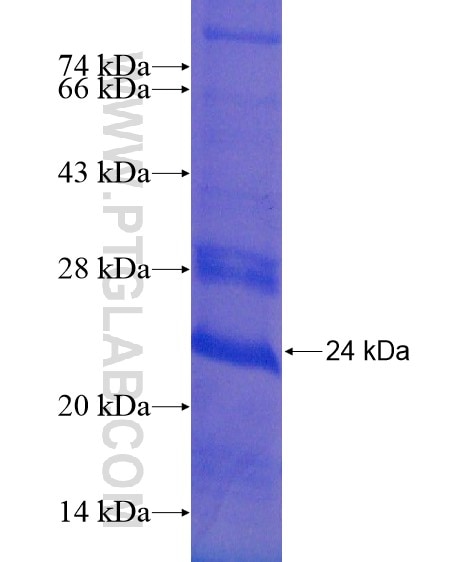 INHBC fusion protein Ag21358 SDS-PAGE