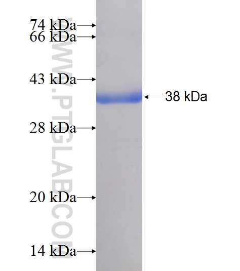 INI-1 fusion protein Ag7918 SDS-PAGE
