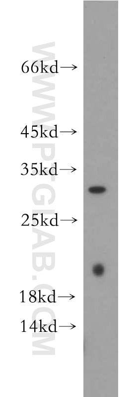 Western Blot (WB) analysis of mouse pancreas tissue using INMT Polyclonal antibody (21578-1-AP)