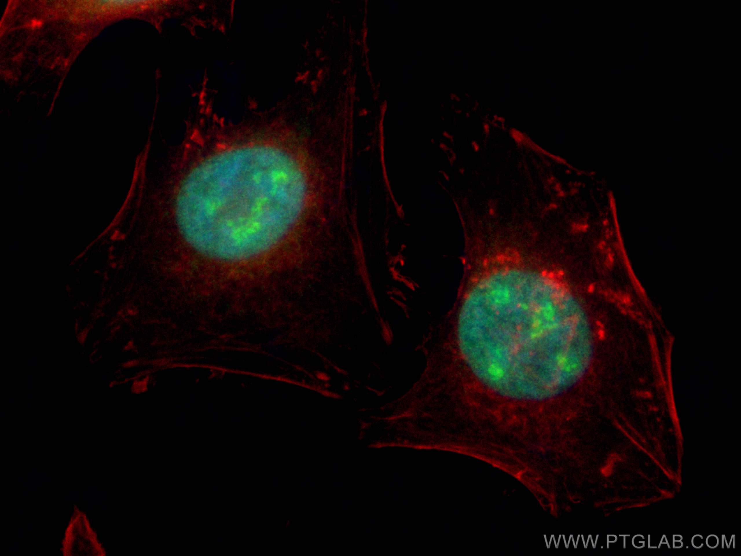 Immunofluorescence (IF) / fluorescent staining of HeLa cells using INO80 Polyclonal antibody (18810-1-AP)
