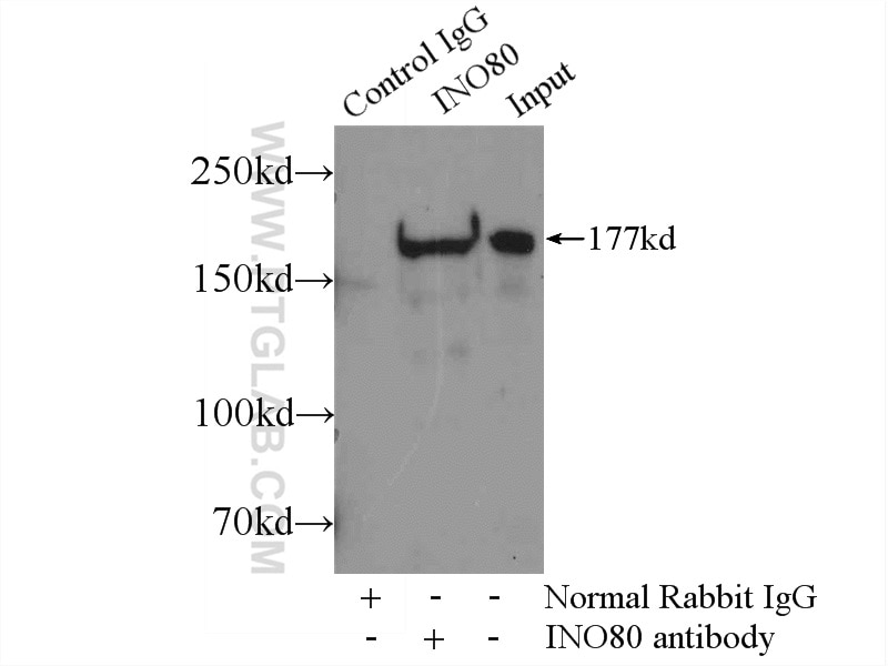 Immunoprecipitation (IP) experiment of HeLa cells using INO80 Polyclonal antibody (24819-1-AP)