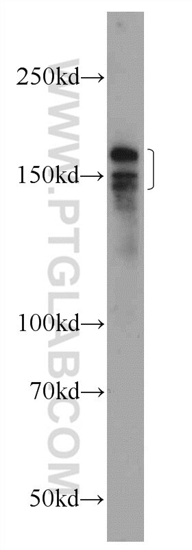 Western Blot (WB) analysis of HepG2 cells using INO80 Polyclonal antibody (24819-1-AP)