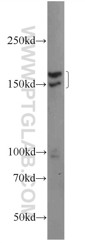 Western Blot (WB) analysis of HeLa cells using INO80 Polyclonal antibody (24819-1-AP)