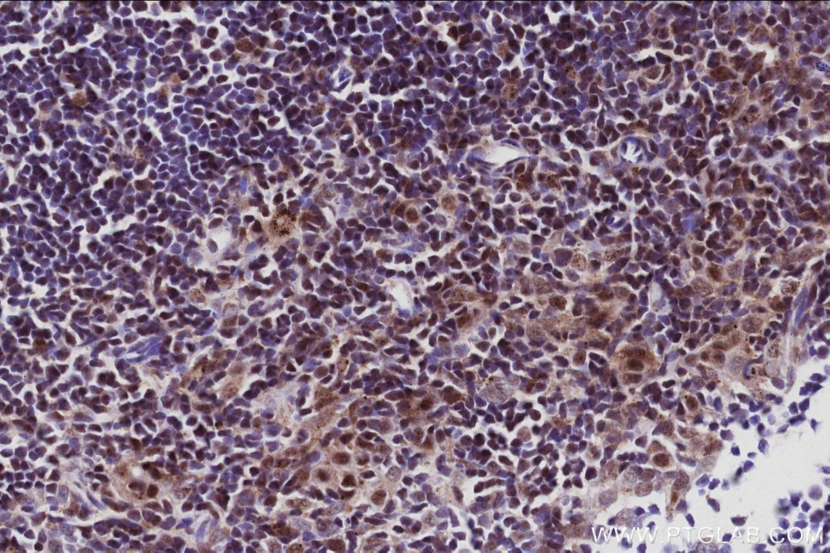 Immunohistochemistry (IHC) staining of mouse thymus tissue using INO80 Recombinant monoclonal antibody (83117-4-RR)