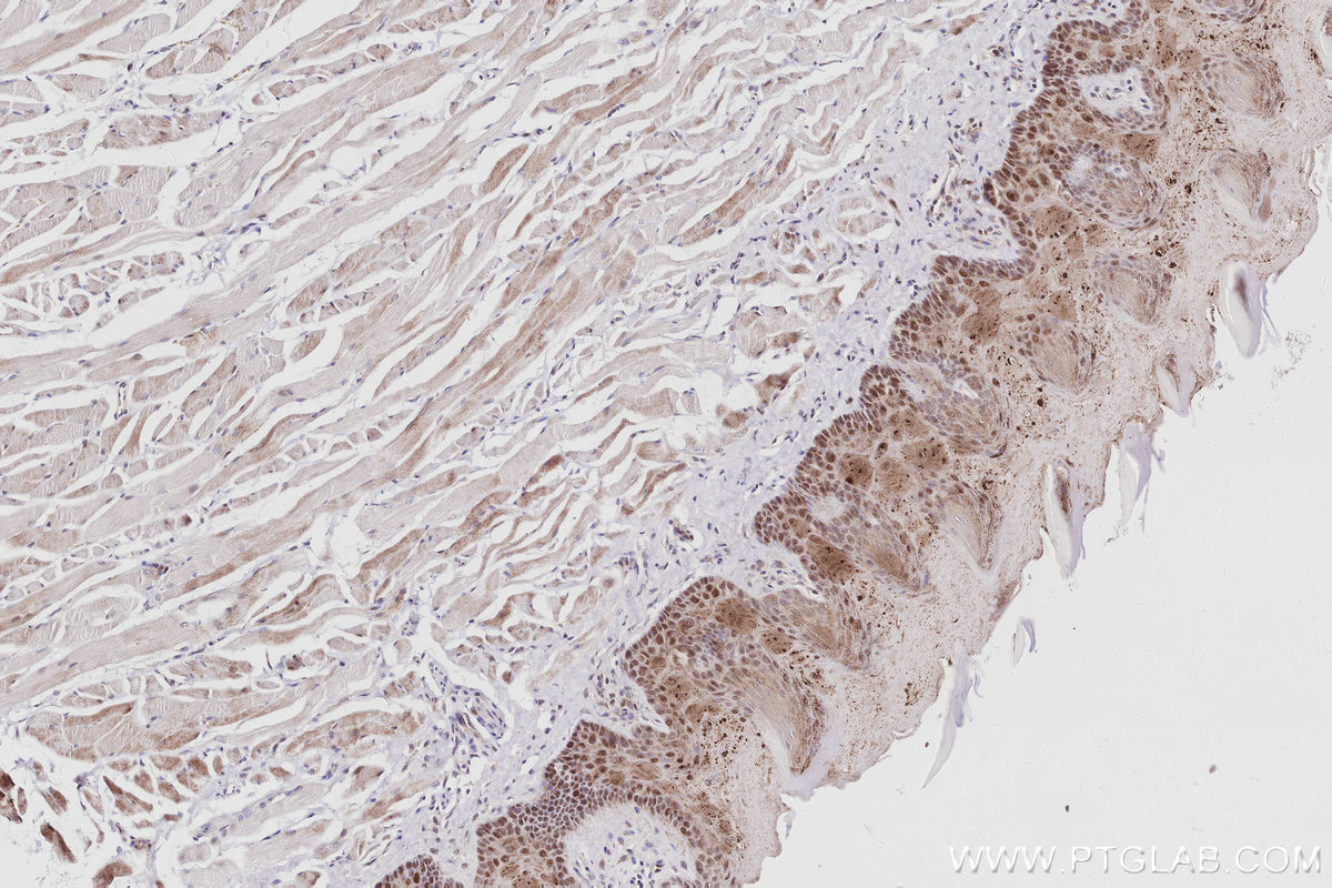 Immunohistochemistry (IHC) staining of rat tongue tissue using INO80 Recombinant monoclonal antibody (83117-4-RR)