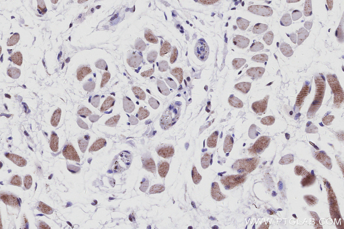 Immunohistochemistry (IHC) staining of mouse tongue tissue using INO80 Recombinant monoclonal antibody (83117-4-RR)