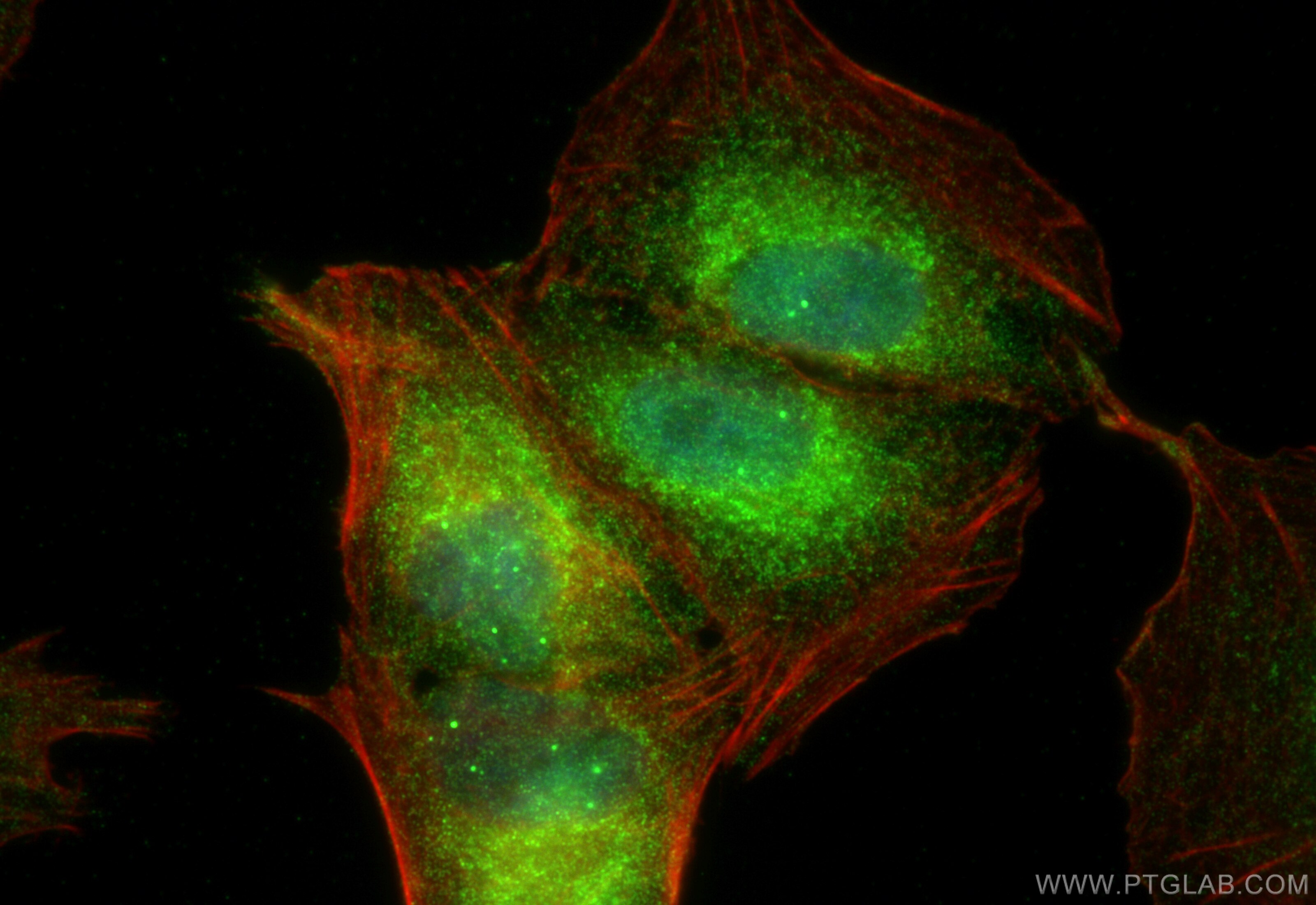 Immunofluorescence (IF) / fluorescent staining of A549 cells using INPP4A Polyclonal antibody (12665-1-AP)