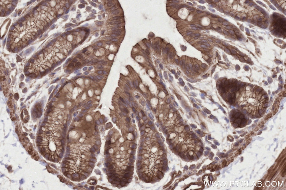 IHC staining of mouse colon using 12665-1-AP Immunohistochemistry (IHC) staining of mouse colon tissue using INPP4A Polyclonal antibody (12665-1-AP)