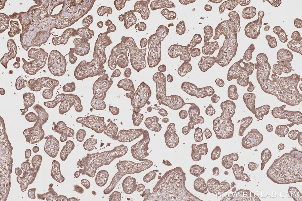 IHC staining of human placenta using 12665-1-AP Immunohistochemistry (IHC) staining of human placenta tissue using INPP4A Polyclonal antibody (12665-1-AP)