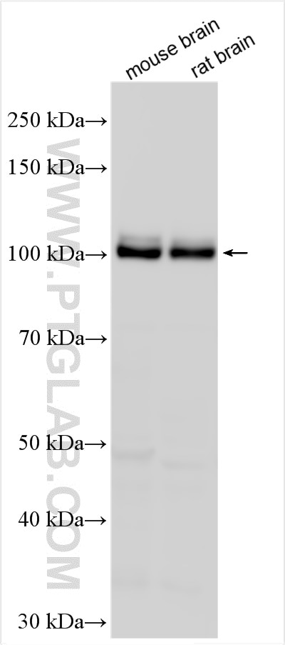 Western Blot (WB) analysis of various lysates using INPP4A Polyclonal antibody (12665-1-AP)