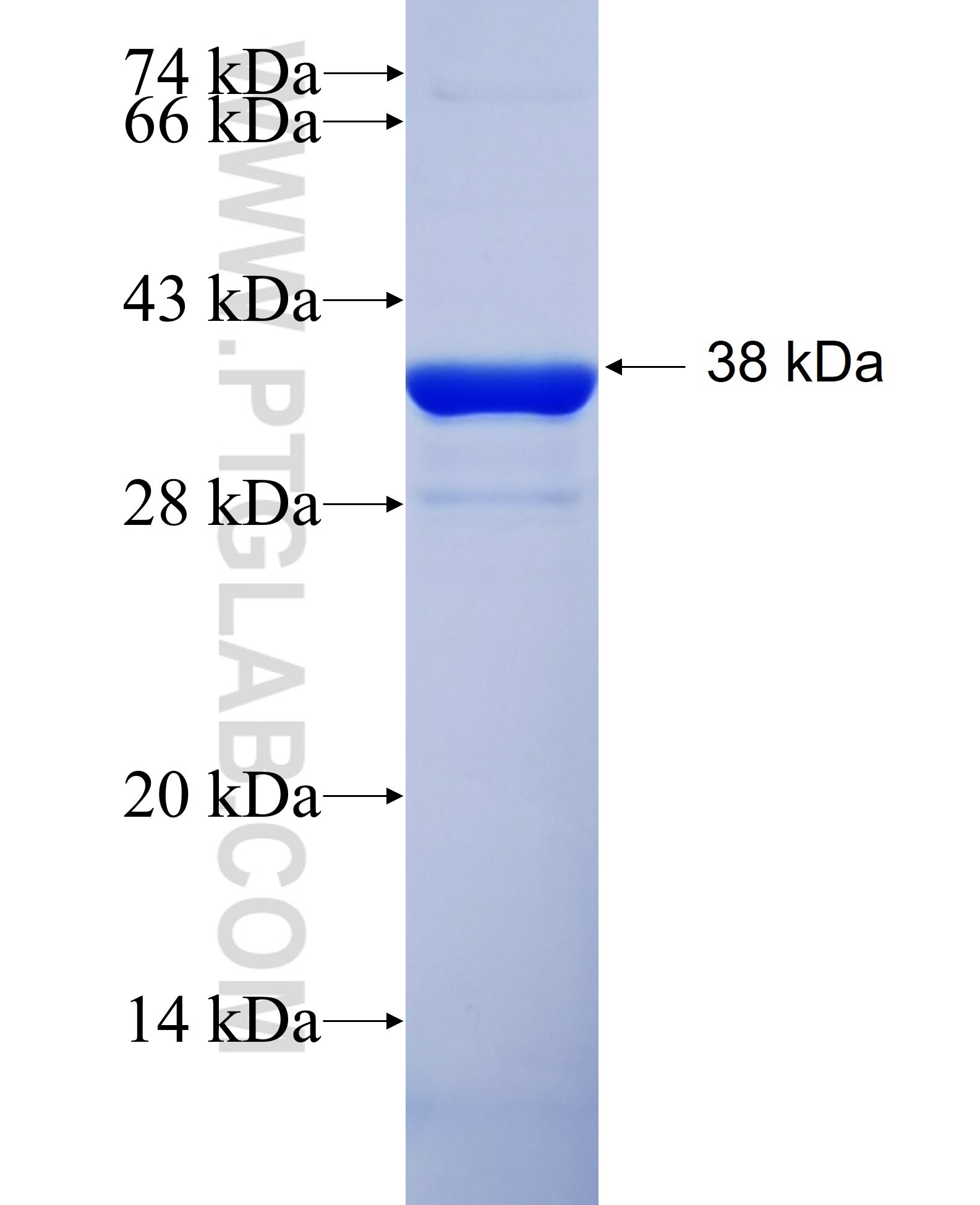 INPP4B fusion protein Ag8676 SDS-PAGE