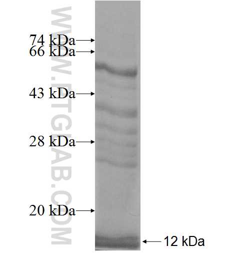 INPP4B fusion protein Ag8689 SDS-PAGE