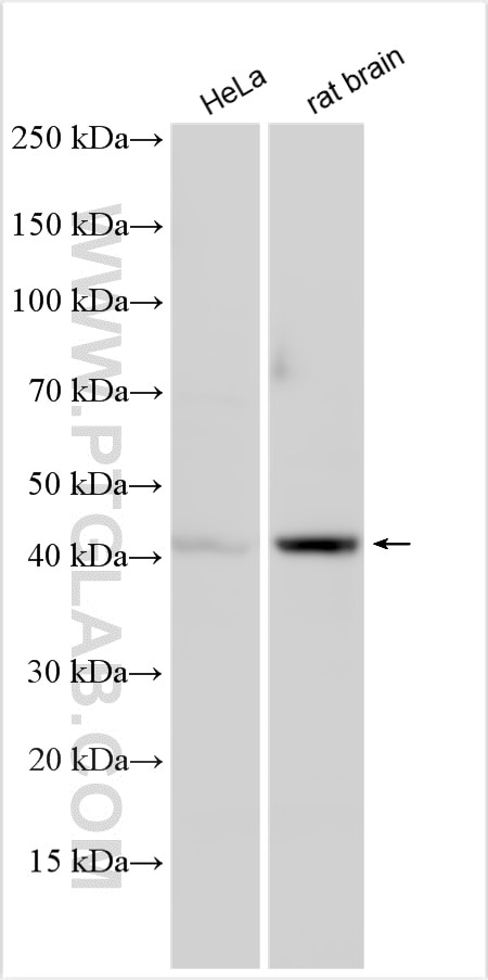 Western Blot (WB) analysis of various lysates using INPP5A Polyclonal antibody (21723-1-AP)