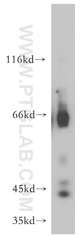 Western Blot (WB) analysis of human brain tissue using INPP5A Polyclonal antibody (21723-1-AP)