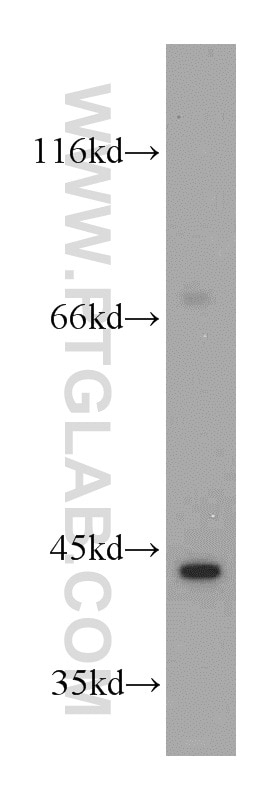 Western Blot (WB) analysis of HeLa cells using INPP5A Polyclonal antibody (21723-1-AP)