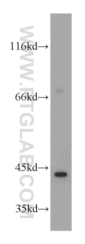 WB analysis of HeLa using 21723-1-AP