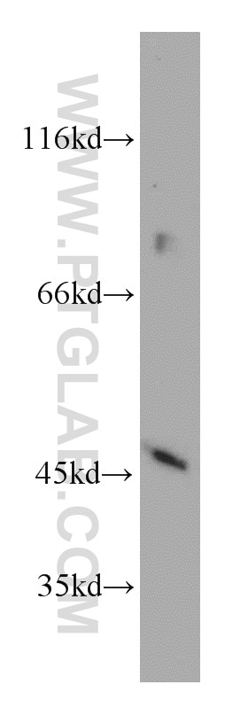 Western Blot (WB) analysis of COLO 320 cells using INPP5A Polyclonal antibody (21723-1-AP)
