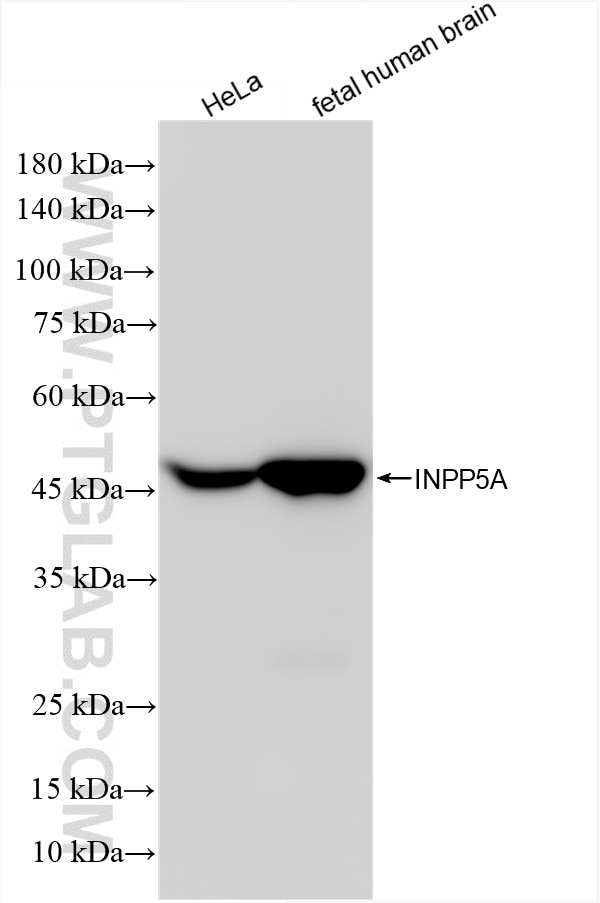 Western Blot (WB) analysis of various lysates using INPP5A Recombinant antibody (86001-1-RR)
