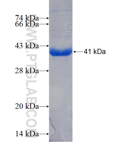 INPP5A fusion protein Ag17156 SDS-PAGE