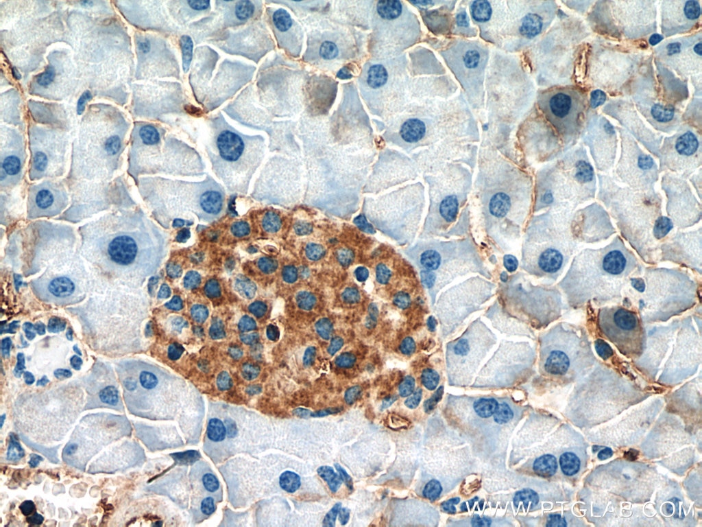 Immunohistochemistry (IHC) staining of mouse pancreas tissue using INPP5B Polyclonal antibody (15141-1-AP)
