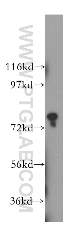 Western Blot (WB) analysis of HeLa cells using INPP5B Polyclonal antibody (15141-1-AP)