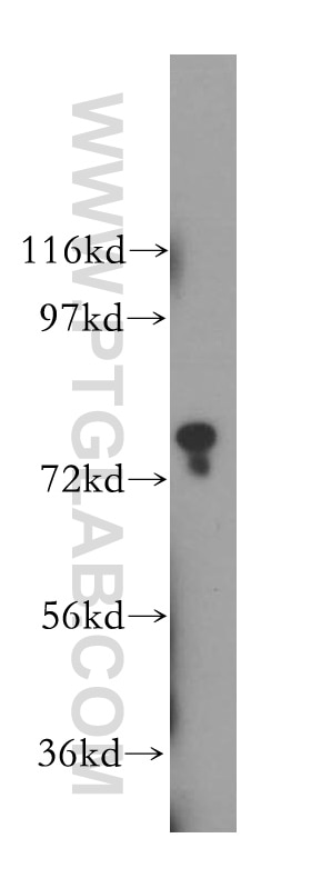 Western Blot (WB) analysis of HeLa cells using INPP5B Polyclonal antibody (15141-1-AP)