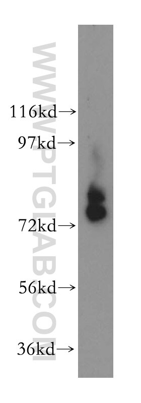 Western Blot (WB) analysis of human placenta tissue using INPP5B Polyclonal antibody (15141-1-AP)