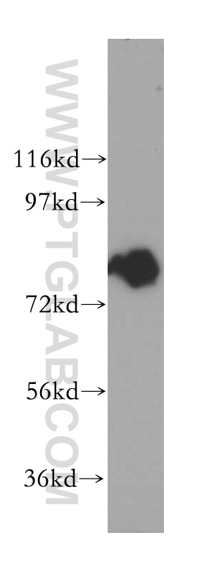 Western Blot (WB) analysis of mouse spleen tissue using INPP5B Polyclonal antibody (15141-1-AP)
