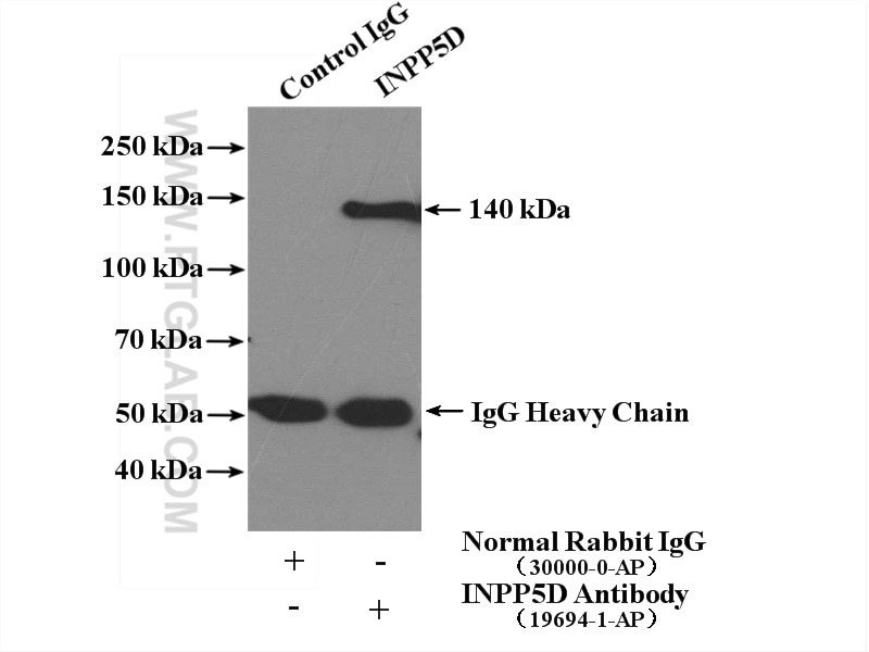 Immunoprecipitation (IP) experiment of Ramos cells using INPP5D Polyclonal antibody (19694-1-AP)