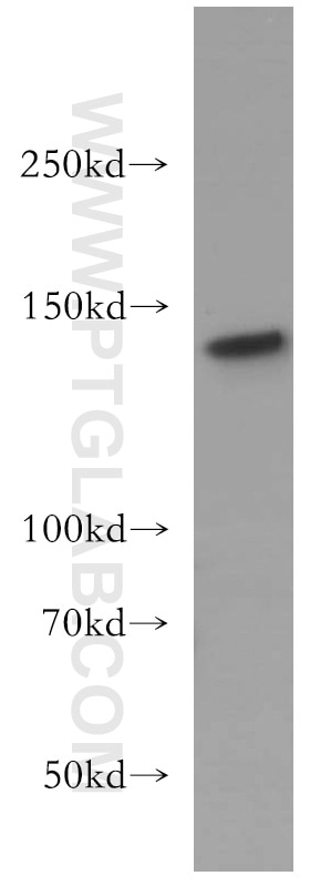 Western Blot (WB) analysis of Jurkat cells using INPP5D Polyclonal antibody (19694-1-AP)