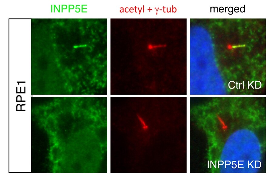 Immunofluorescence (IF) / fluorescent staining of hTERT-RPE1 cells using INPP5E Polyclonal antibody (17797-1-AP)