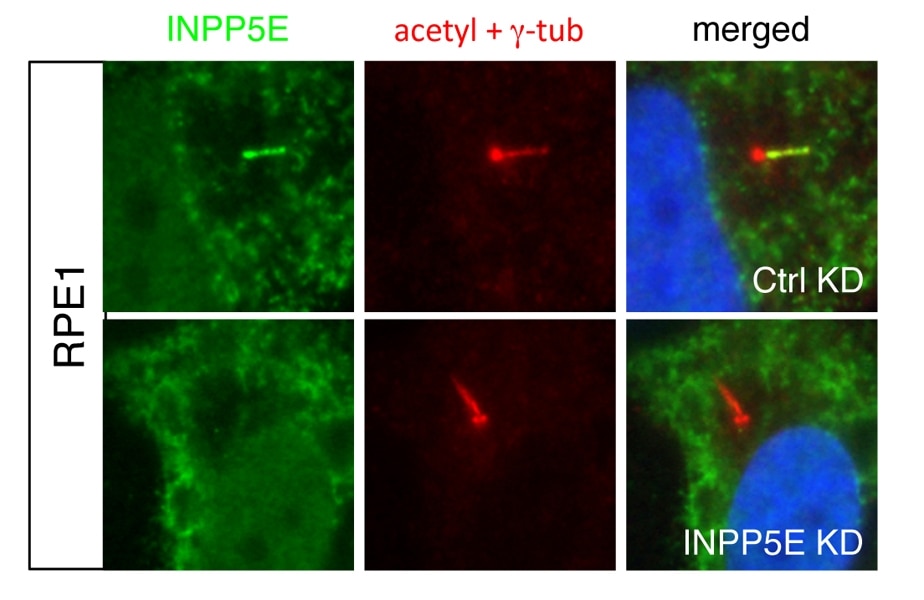 IF Staining of hTERT-RPE1 cells using 17797-1-AP