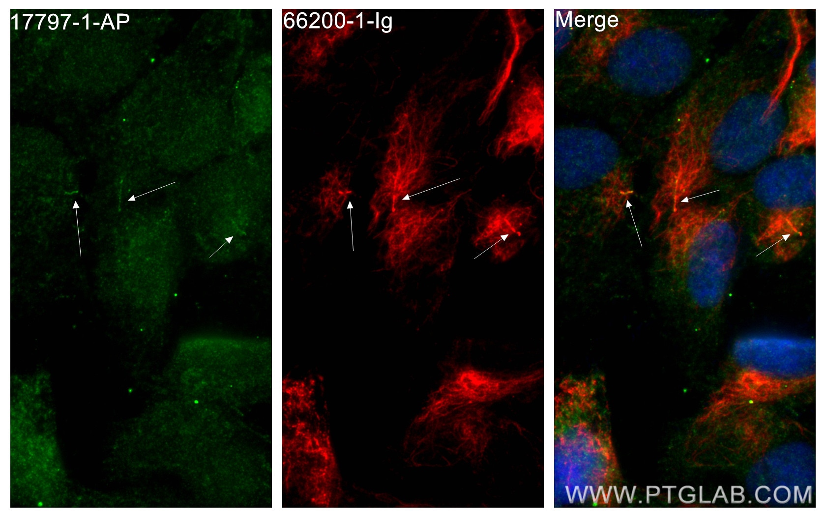 Immunofluorescence (IF) / fluorescent staining of hTERT-RPE1 cells using INPP5E Polyclonal antibody (17797-1-AP)