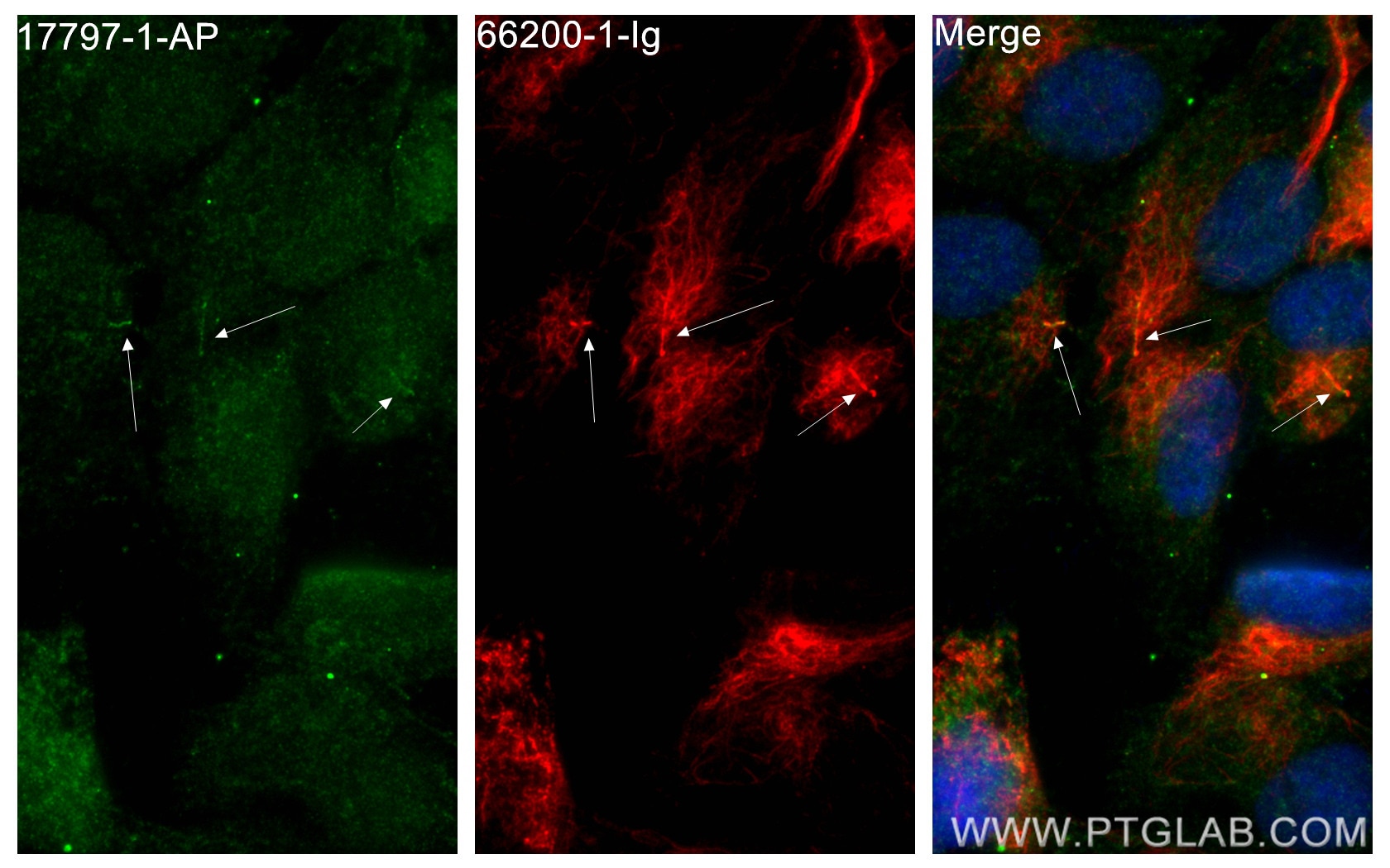 IF Staining of hTERT-RPE1 using 17797-1-AP