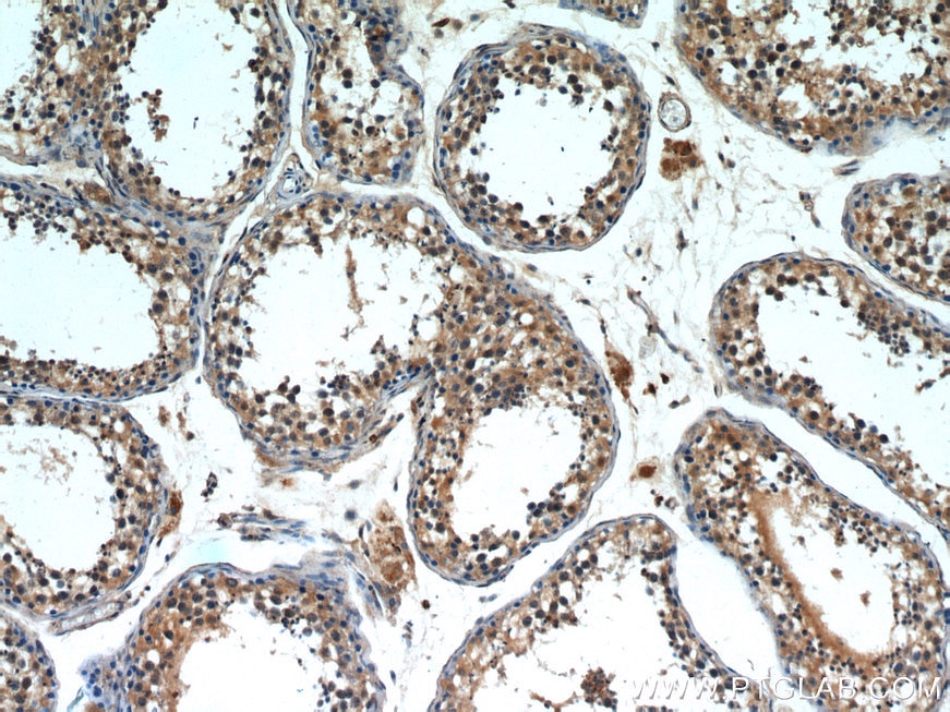 Immunohistochemistry (IHC) staining of human testis tissue using INPP5E Polyclonal antibody (17797-1-AP)