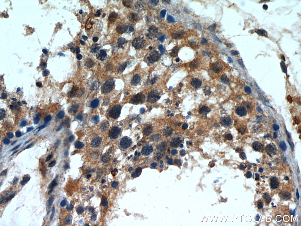 Immunohistochemistry (IHC) staining of human testis tissue using INPP5E Polyclonal antibody (17797-1-AP)